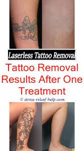 Due to all these variables, it is hard to say how many laser sessions you will need, but a laser tattoo removal consultation can usually provide you with an estimate. Is It Painful To Remove A Tattoo How Many Sessions To Get A Tattoo Removed Who Can Do Laser Tattoo Removal Tattoo Removal 3689377725 Fasttattooremoval