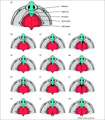 genetics of oro clefting