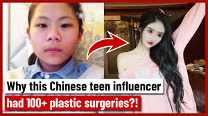 chinese s extreme plastic surgery