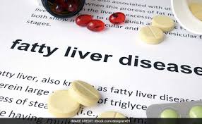do you have fatty liver these are the