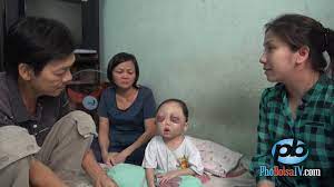 Bé gái xấu số, 2 tuổi đã bị mù mắt và bệnh ung thư máu - YouTube