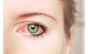 eye infections signature eye care