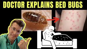skin to repel bed bugs
