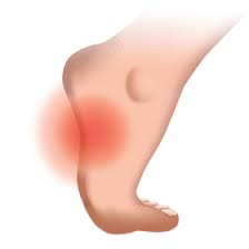 This usually occurs as a result of a neurological disorder such. Foot Solutions Arch Pain Causes And Treatments