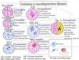 Tv S Senility Be Gone Plot Neurologist Responds gambar png