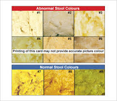 Stool Color Chart 6 Free Download For Pdf Stool Light In