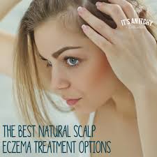 the best natural scalp eczema treatment