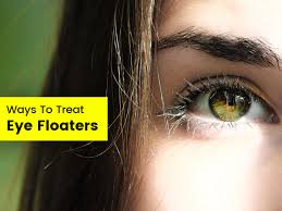what are eye floaters 5 methods by