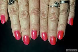 5 1 8 psoriasis artificial nails to