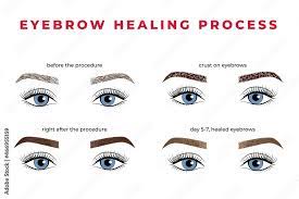 the eyebrow healing process after