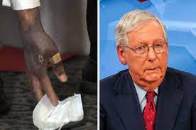 Mitch McConnell's Hand Discolored; He ...