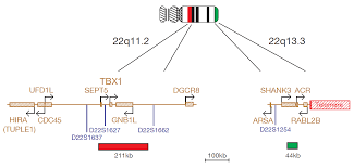 The clinical, immunological, and molecular spectrum of chromosome 22q11.2 deletion syndrome and digeorge syndrome. Digeorge Tbx1 And 22q13 3 Deletion Syndrome Probe Combination