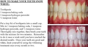 Baking soda can weaken the adhesive for those wearing braces or permanent dental appliances. How To Have White Teeth With Baking Soda Arxiusarquitectura