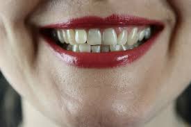 Rasa macam ada 'something' melekat pada gigi . Tips Penjagaan Gigi Dan Gusi Yang Patut Anda Amalkan Tips Kesihatan