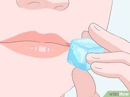 6 ways to get rid of a cold sore wikihow