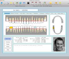 Datacon Charting System Released Datacon Dental Systems