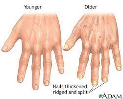 aging changes in nails medlineplus