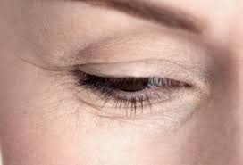 undereye treatment for wrinkles fine