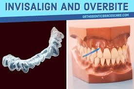 Maybe you would like to learn more about one of these? Can Invisalign Really Fix An Overbite Orthodontic Braces Care
