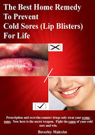prevent cold sores lip blisters