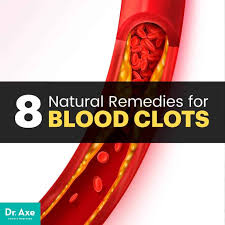 blood clots causes symptoms 8