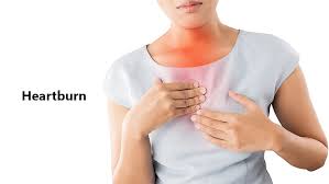 Heartburn: Causes, Symptoms, Treatment, And Prevention Medlife