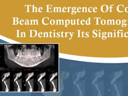 cone beam ct in dentistry significance