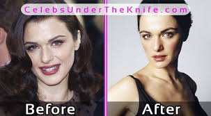 Rachel weisz plastic surgery is one of the topics being highly debated. Rachel Weisz Plastic Surgery Photos Before After