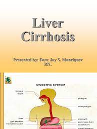 It is a progressive disease that wastes away your liver to the point of no return. Pathophysiology On Liver Cirrhosis Ppt Cirrhosis Liver