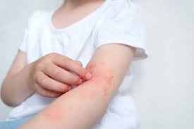 urgent sick visit for your child s rash