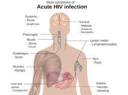 how does hiv aids affect the mouth