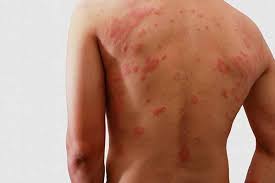 skin rash symptoms causes emergency