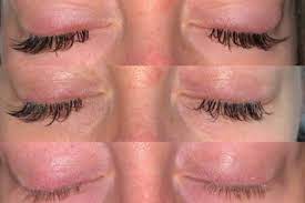 incorrectly applied eyelash extensions