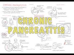 Pancreatitis Physiopedia