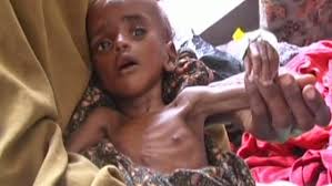 Hladomor v Somálsku stihne podle OSN další regiony — ČT24 — Česká televize