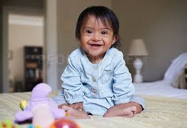 happy baby with down syndrome portrait