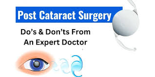 post cataract surgery do s don ts