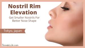 nostril rim elevation get smaller