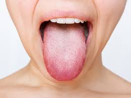 white tongue symptoms causes and