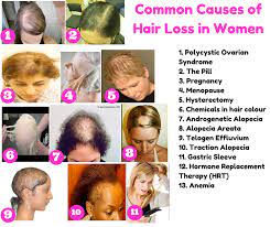 the top 10 causes of hair loss in women