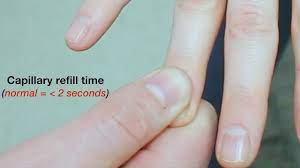 capillary nail refill you