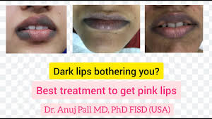 dark lips laser treatment