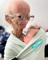 Did Adalia Rose have a baby?