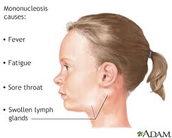 swollen lymph nodes information mount