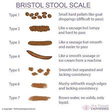 Bristol Stool Chart A Gutsy Girl