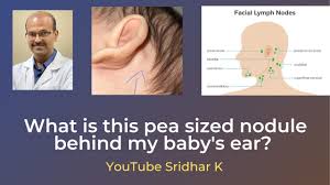 pea like swelling behind my baby s ears