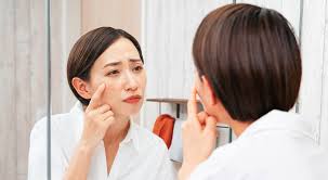 how to treat dry skin around eyes easy