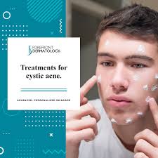 treatments for cystic acne forefront
