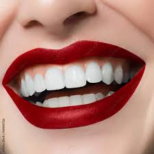 beautiful smile with whitening teeth
