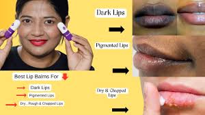 the derma co 1 kojic acid lip balm